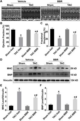 Berberine Promotes Cardiac Function by Upregulating PINK1/Parkin-Mediated Mitophagy in Heart Failure